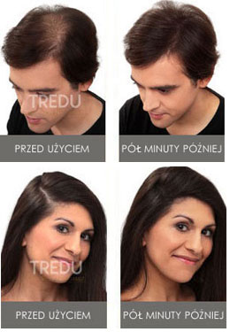 Toppik Hair Thickener efekt