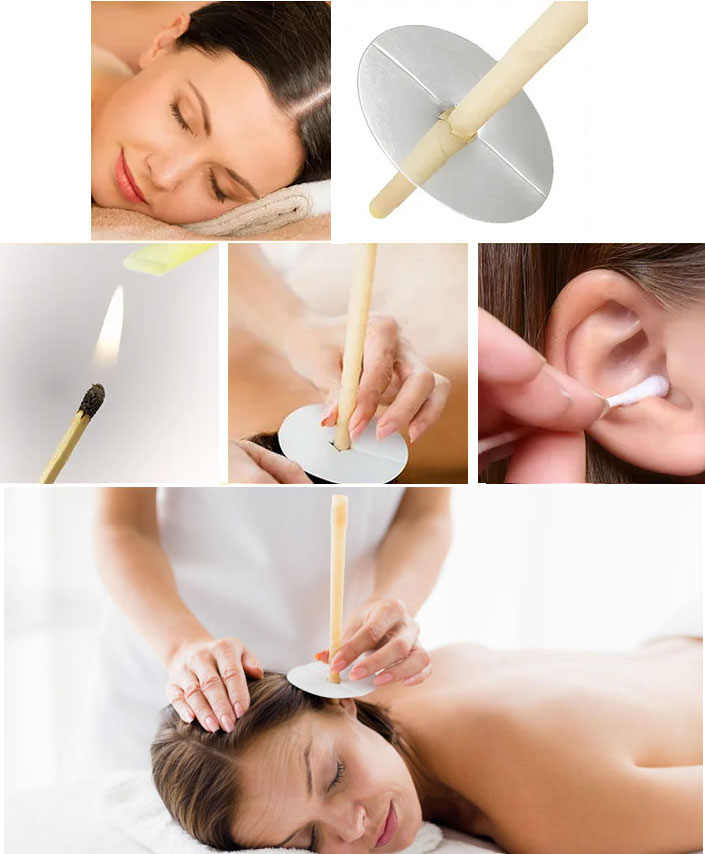 ear candle