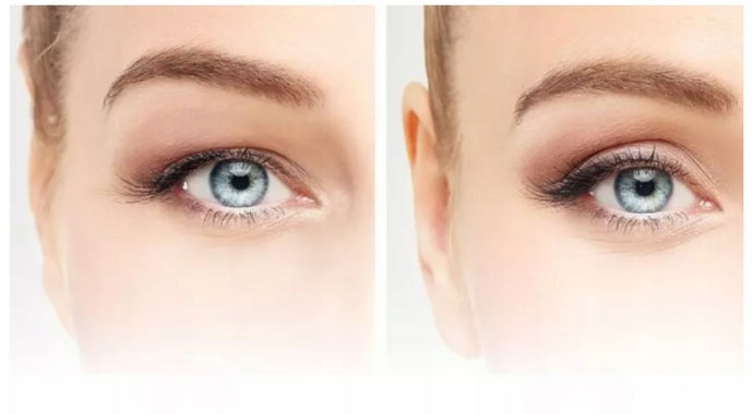 EELHOE Eyelid Styling