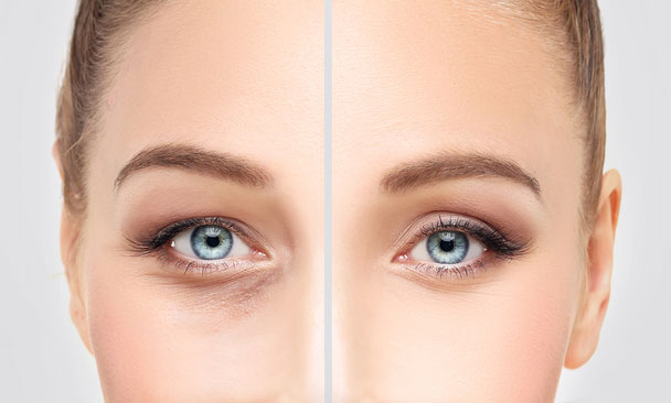 EELHOE Eyelid Styling