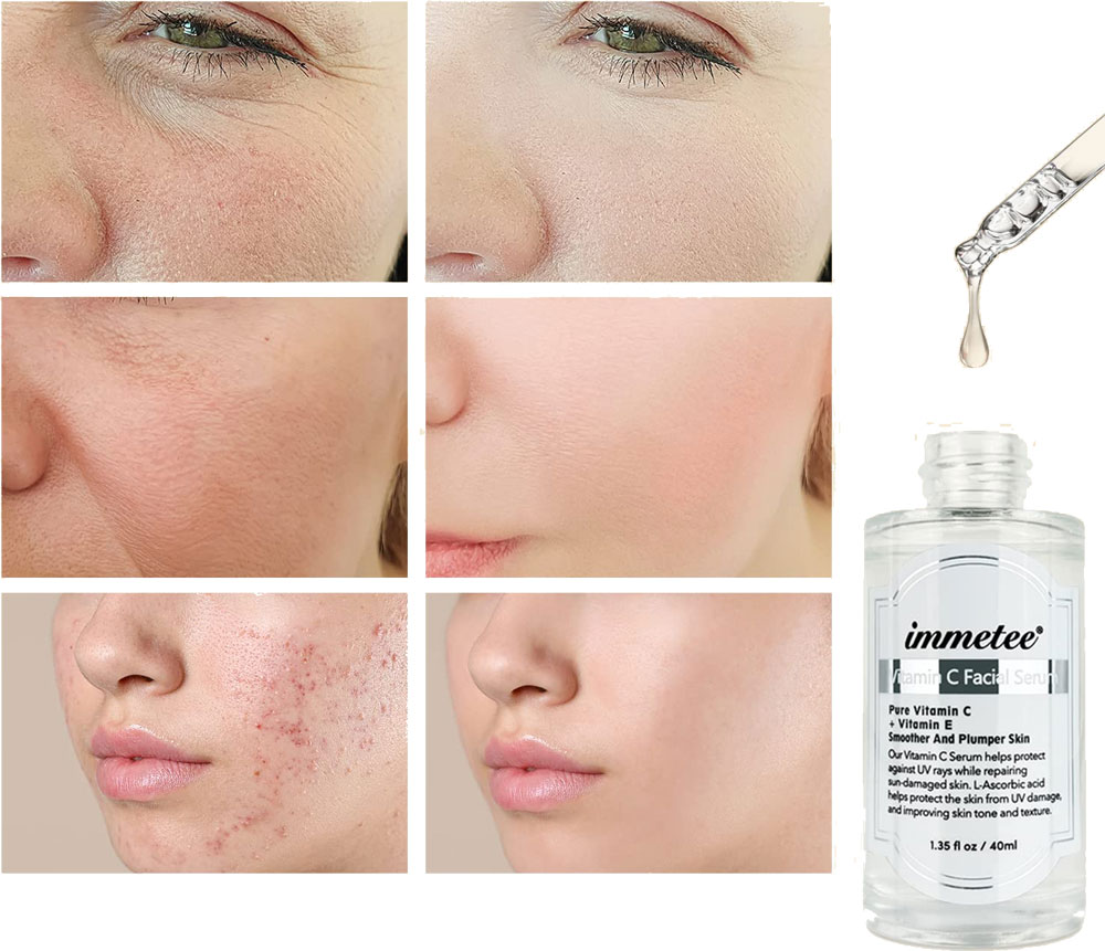 Immetee Vitamin C Serum