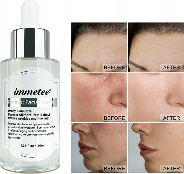 Retinol Serum