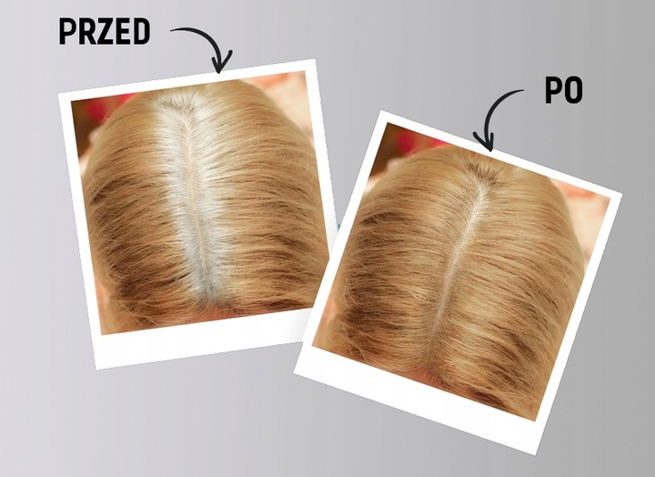 Root Perfect Przed/Po