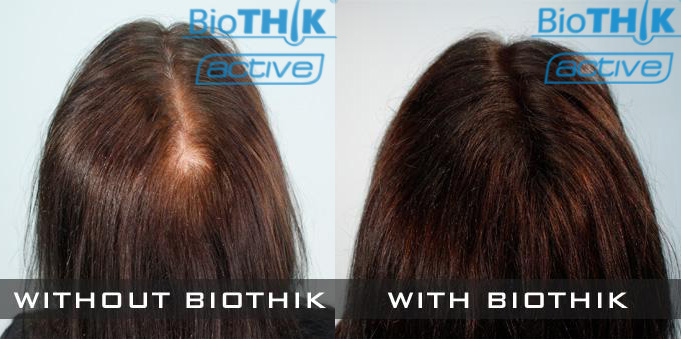 BioTHIK Fibers efekt