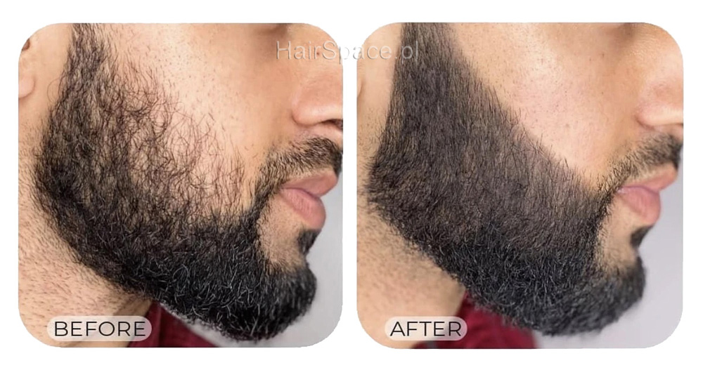 Glovis Beard Filler przed/po