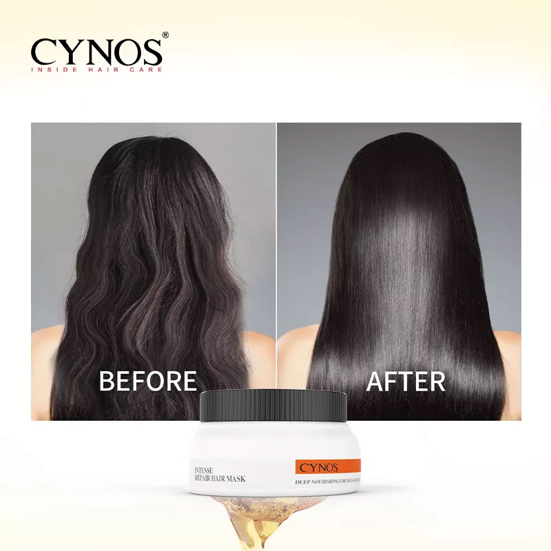 CYNOS