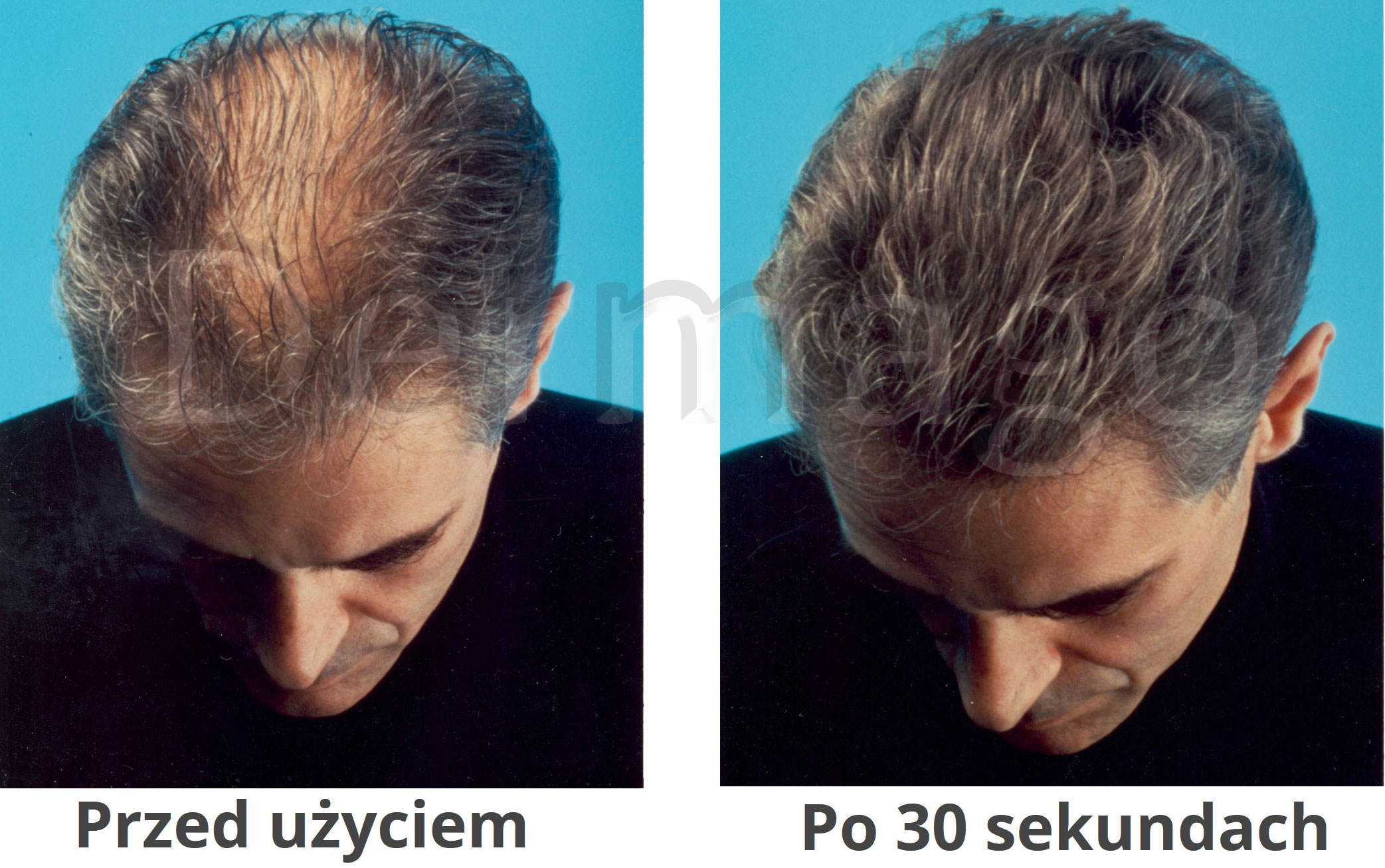 Bodeo Derm efekt