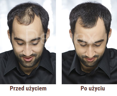 Dermax Hair Fibers efekt