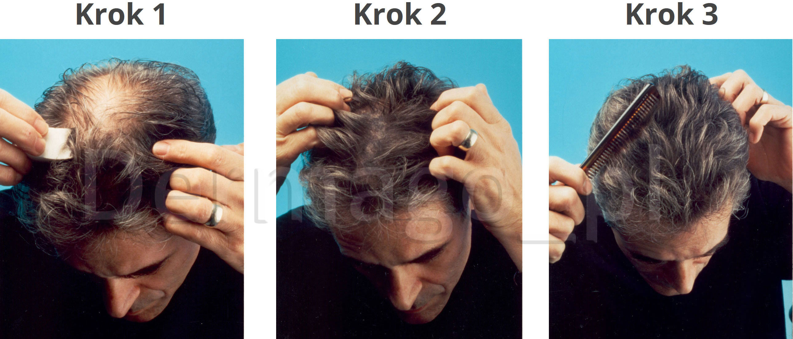 Bodeo Derm kroki