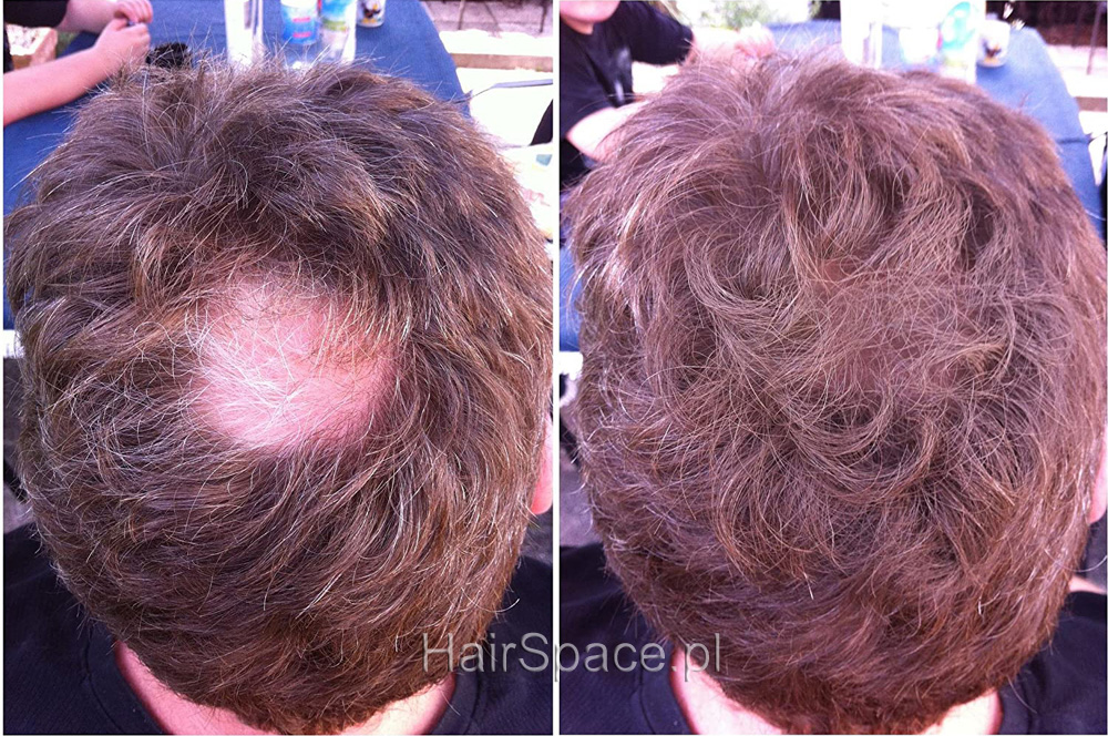 HairFor2 efekt