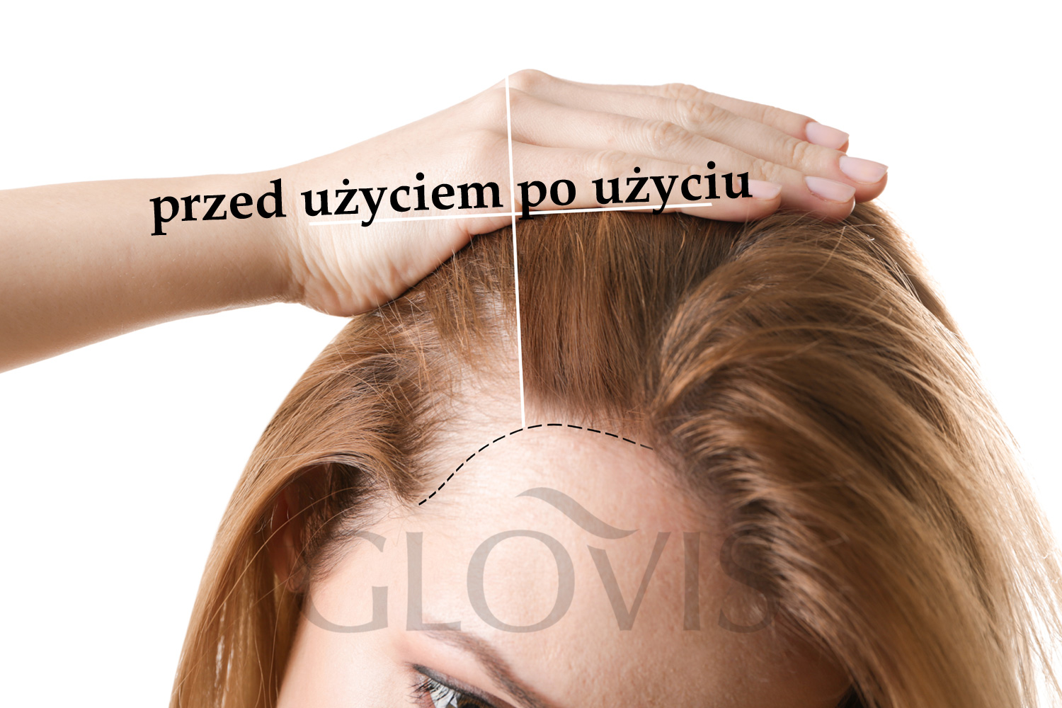 Glovis Serum