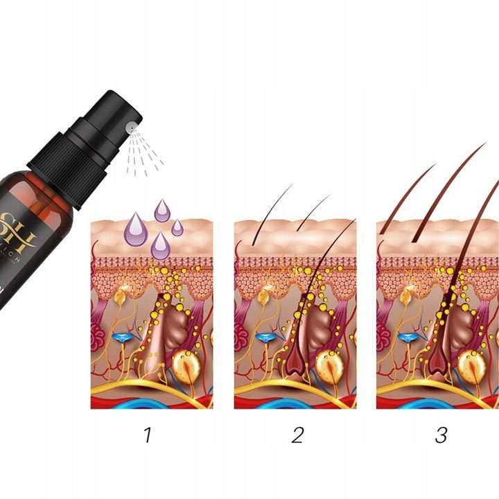 Sevich Onion Black Seed Hair Oil 30ml