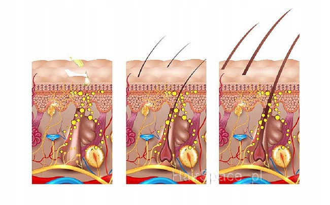 Sevich Hair Growth Spray +