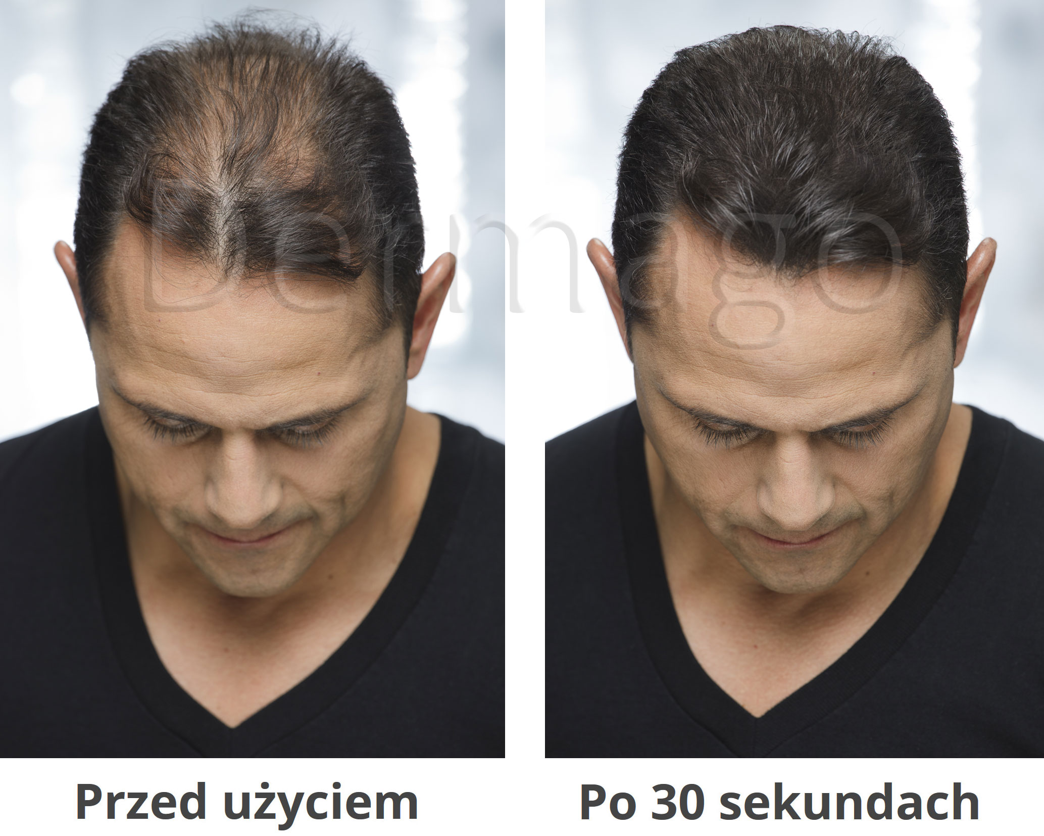 Vickson Fibers efekt