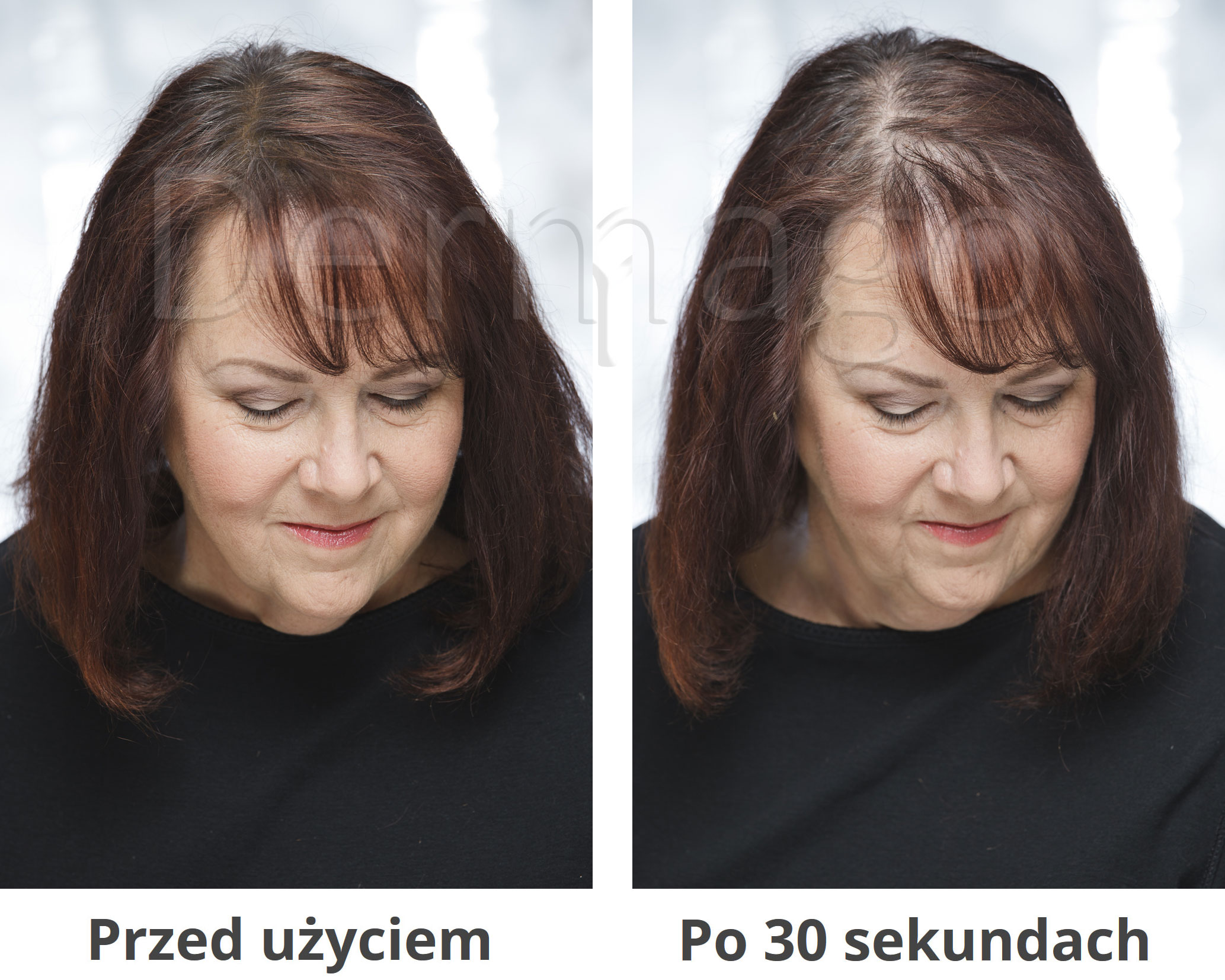 Vickson Fibers efekt 2